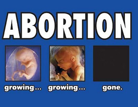 Abortion, Takes, Life, Unborn, Rights, Pro-Life, Pro-Choice, Philosophy, Reasoning
