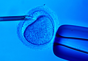 In Vitro Fertilization, IVF, Embryo, Reduction, Abortion, Death