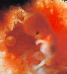 Fetus, Fetal, Development, Baby, Pregnancy, Abortion, Pro-Choice, Pro-Life, Weeks, 11