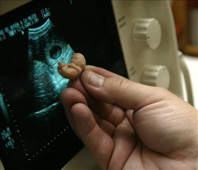 Fetal, Development, Pregnancy, Pro-Choice, Pro-Life, Abortion, 13 Weeks, Weeks