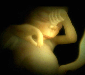 Preborn, Unborn, Fetus, Fetal, Development, Dreams, Pregnancy, Pro-Life, Pro-Choice, Abortion