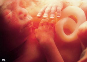 Fetus, Fetal, Development, Pregnancy, Weeks, 20, Abortion, Pregnancy, Pro-Choice, Pro-Life