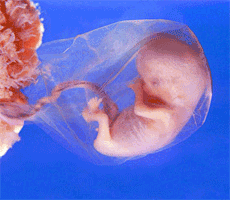 Preborn, Baby, Fetus, Embryo, Development, Pain, 8 weeks, 12 weeks